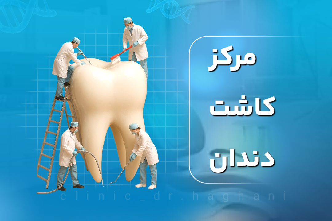 مرکز کاشت دندان در تهران